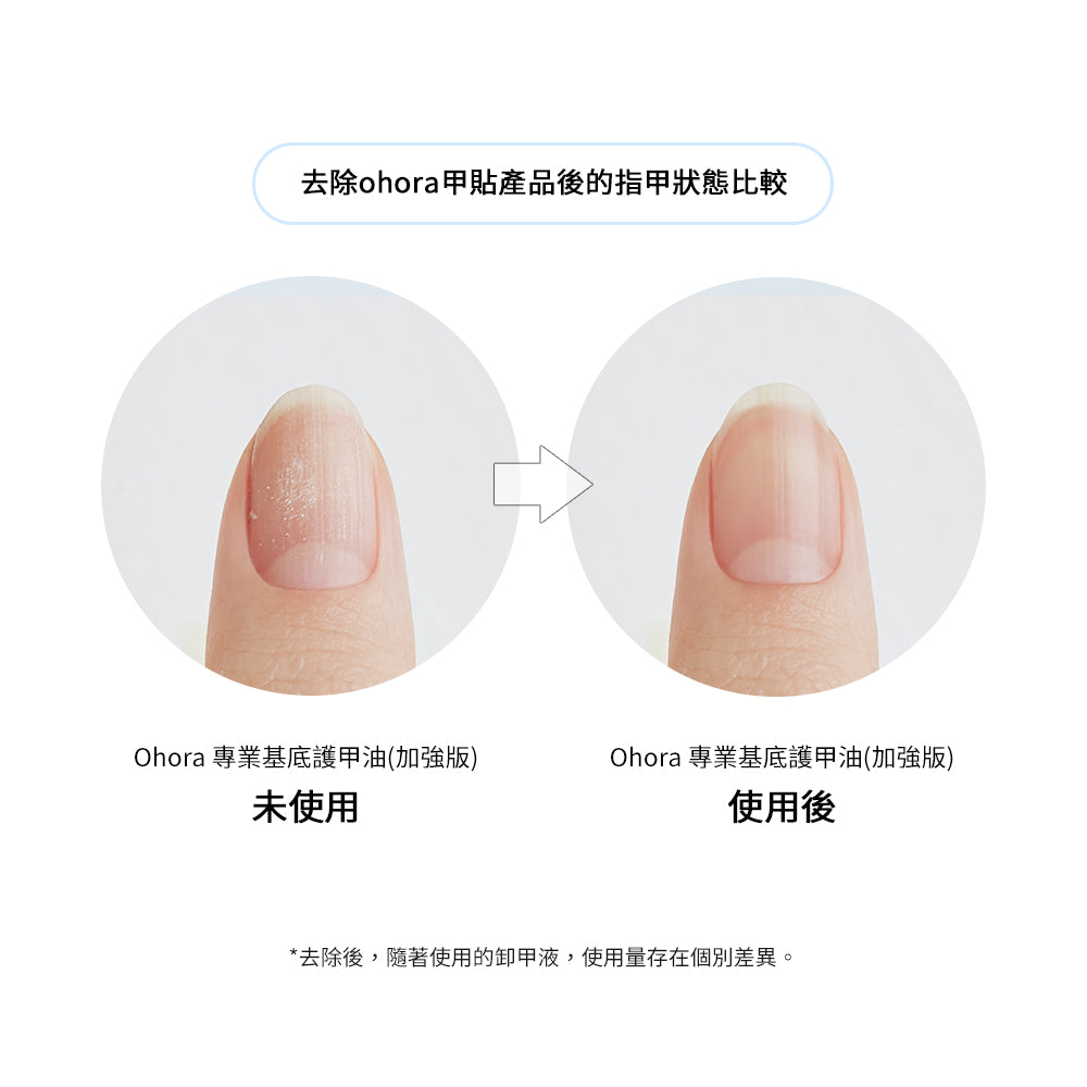 Ohora 強化持久套裝